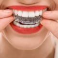 Can Invisalign Move Teeth in 2 Weeks?