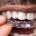 Caring for Your Gums While Wearing Invisalign Aligners