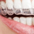 Caring for Your Jaw While Wearing Invisalign Aligners: Expert Tips