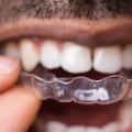 Can I Brush and Floss My Teeth While Wearing Invisalign Aligners?