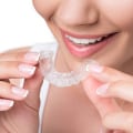 Everything You Need to Know About Invisalign Aligners