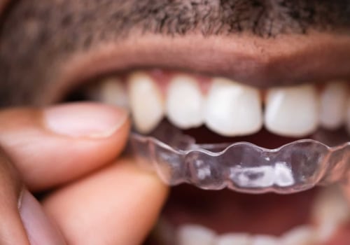 How Often Should You Visit the Dentist While Wearing Invisalign?