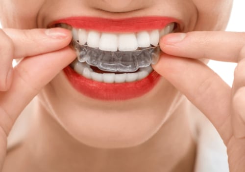 How Long Does It Take for Invisalign to Work?