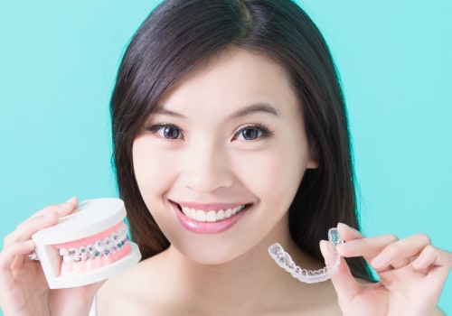 The Benefits of Invisalign Over Traditional Braces