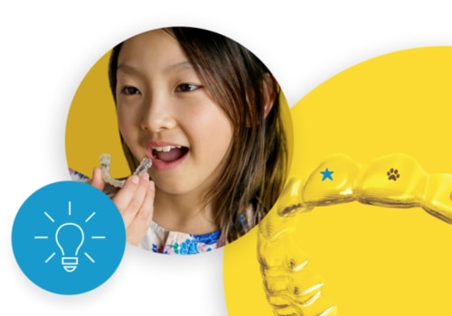 What is the First Step for Invisalign Treatment?