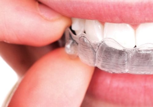 Can I Use Mouthwash While Wearing My Invisalign Aligners?