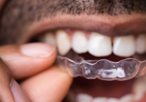 Can I Brush and Floss My Teeth While Wearing Invisalign Aligners?