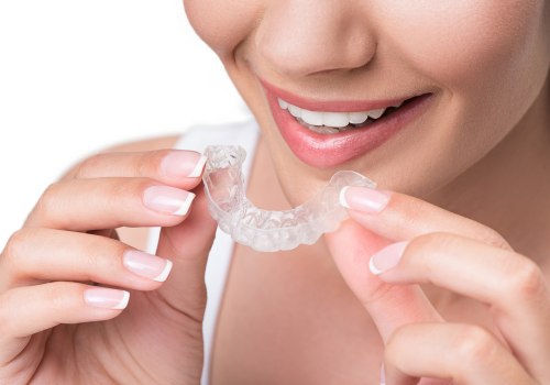 Everything You Need to Know About Invisalign Aligners